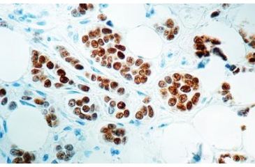 Image of Diagnostic Biosystems Estrogen Receptor CONC. Mab MOB 121