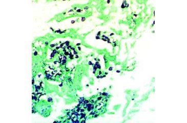 Image of Diagnostic Biosystems G.M.S. Kit 100RXN KT 015