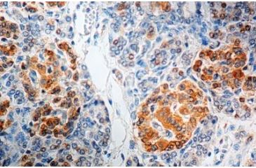 Image of Diagnostic Biosystems GAD65 - Rabbit .5ML RP 075-05