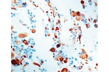 Image of Diagnostic Biosystems Gfap - Clone 6F2 .5ML MOB 199-05