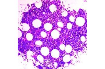 Image of Diagnostic Biosystems Giemsa Kit 100RXN KT 016