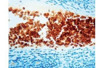 Image of Diagnostic Biosystems Glycophorin A Clone JC159 .5ML MOB 066-05