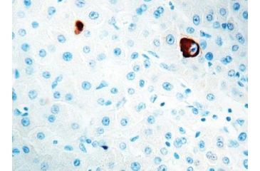 Image of Diagnostic Biosystems Hbsag CONC. Mab MOB 125