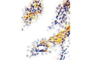 Image of Diagnostic Biosystems Heregulin - Clone 7D5 .5ML MOB 343-05