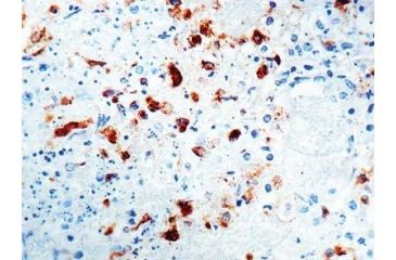 Image of Diagnostic Biosystems Hsv Type Ii Rtu Mab PDM 081