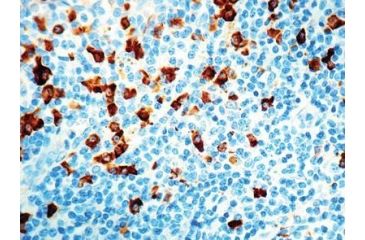 Image of Diagnostic Biosystems Iga CONC. Polyclonal Ab RP 020