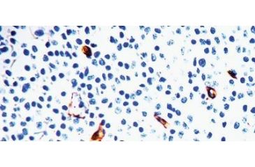 Image of Diagnostic Biosystems Ige - Rabbit .5ML RP 022-05