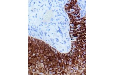 Image of Diagnostic Biosystems INTENSI/FIRE 15ML K 045