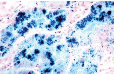 Image of Diagnostic Biosystems Iron Stain Kit 100RXN KT 021