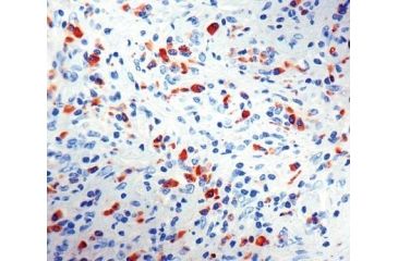 Image of Diagnostic Biosystems Kappa Light Chain CONC. Mab MOB 075-01