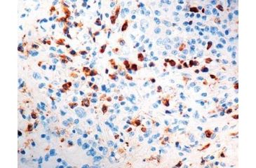 Image of Diagnostic Biosystems Kappa Light Chain Rtu Pab PDR 015