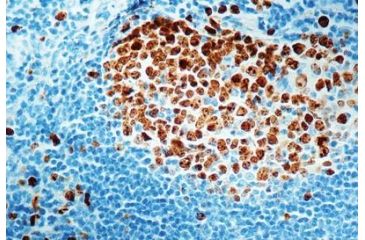 Image of Diagnostic Biosystems KI-67 Antigen CONC. Mab MOB 237