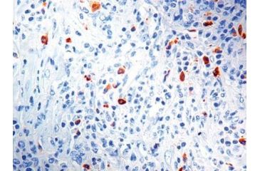 Image of Diagnostic Biosystems Lambda Light Chain CONC. Mab MOB 201