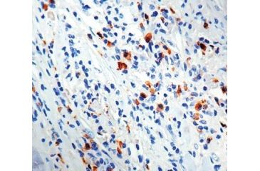 Image of Diagnostic Biosystems Lambda Light Chain Rabbit .5ML RP 027-05