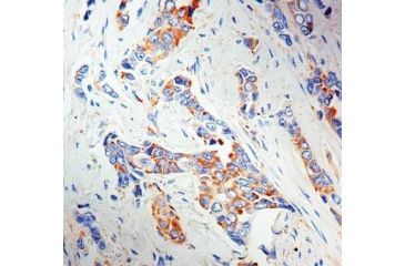 Image of Diagnostic Biosystems LRP/MVP - Clone 1032 .5ML MOB 344-05