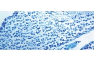 Image of Diagnostic Biosystems Luxol Fast Blue Kit 100RXN KT 022