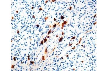 Image of Diagnostic Biosystems Macrophage - Clone MAC387 .5ML MOB 203-05