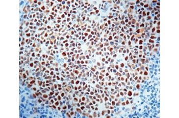 Image of Diagnostic Biosystems MSH2 - Clone 25D12 .5ML MOB 332-05