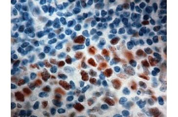 Image of Diagnostic Biosystems MSH6 Clone 44 PDM 147