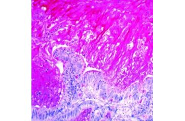 Image of Diagnostic Biosystems Mucicarmine Kit 100RXN KT 024