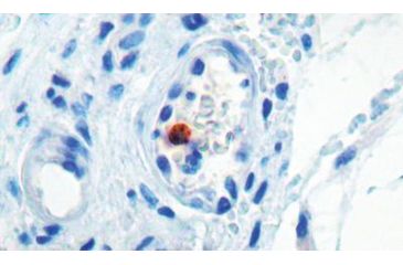 Image of Diagnostic Biosystems MYOD1 - Clone 5.2F .5ML MOB 278-05