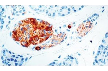 Image of Diagnostic Biosystems Neuron Spec Enol VI-H14 .5ML MOB 212-05