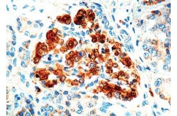 Image of Diagnostic Biosystems Nse Rtu Polyclonal Ab PDR 006