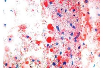 Image of Diagnostic Biosystems Oil Red O Kit 100RXN KT 025