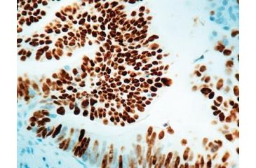 Image of Diagnostic Biosystems P53 Protein - Clone DO7 .5ML MOB 082-05