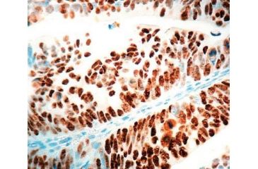 Image of Diagnostic Biosystems P53 Rtu Mab PDM 035