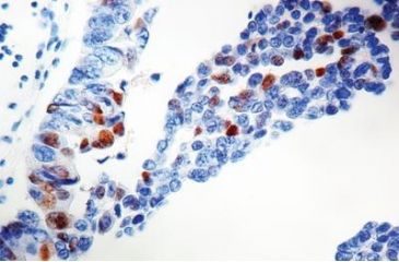 Image of Diagnostic Biosystems P57KIP2 - Clone 57P06 .5ML MOB 291-05