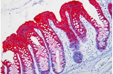 Image of Diagnostic Biosystems PERMARED/AP K 049-110