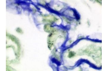Image of Diagnostic Biosystems Pneumocystis Kit 100RXN KT 030