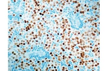 Image of Diagnostic Biosystems Progesterone Receptor Rab .5ML RP 146-05