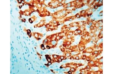 Image of Diagnostic Biosystems Prohibitin CONC. Mab MOB 323