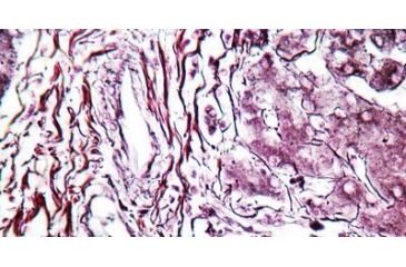 Image of Diagnostic Biosystems Reticulum CHANDLERS Kt 100RXN KT 031
