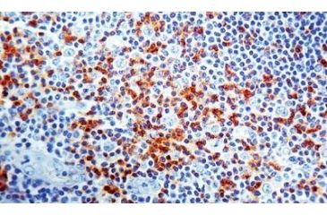 Image of Diagnostic Biosystems CD45RO T Cell CONC. Mab MOB 043
