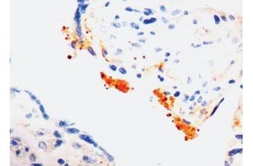 Image of Diagnostic Biosystems Thrombospondin CONC. Mab MOB 315