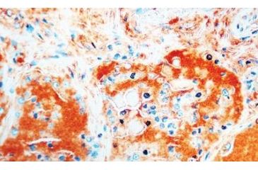 Image of Diagnostic Biosystems Thyroglobulin - Clone 1D4 .5ML MOB 223-05