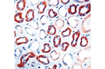 Image of Diagnostic Biosystems Vascular Endothel Gf VG1 .5ML MOB 308-05