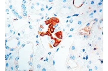 Image of Diagnostic Biosystems Vegf - Rabbit .5ML RP 121-05