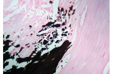 Image of Diagnostic Biosystems Von Kossa Kit 100RXN KT 028