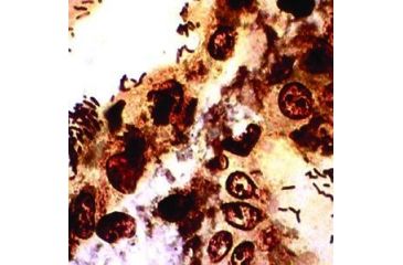 Image of Diagnostic Biosystems WARTHIN-STARRY Kit 100RXN KT 036