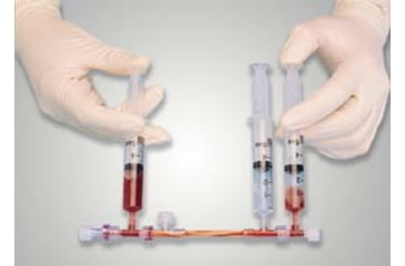 Image of Spectrum Laboratories Microkros Mdl 0.1UM 3X PK10 X11M30010N