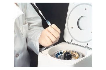 Image of Whatman CENTREX Microfiltration System, Whatman 10467013 Cellulose Acetate Membrane