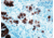 Diagnostic Biosystems Acth CONC. Mab MOB 244