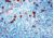 Diagnostic Biosystems ALPHA-1-ANTICHYMOTRYPSIN Rtu PDR 023