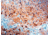 Diagnostic Biosystems Amyloid A Component Rtu Mab PDM 118