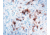 Diagnostic Biosystems Calretinin - Rabbit .5ML RP 043-05