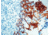 Diagnostic Biosystems Cytokeratin Pan CONC. Mab MOB 108